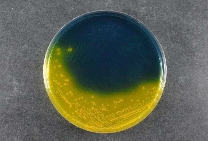 ضمان سلامة الأغذية: يدعم Babio’s Salmonella Shigella Agar (SS) معايير الكشف عن العوامل الممرضة العالمية