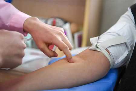 يقدم Babio مجموعة اختبار Typhoid IgG/IgM السريعة لتشخيصات نقطة الرعاية الموثوقة