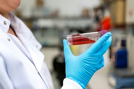 الحفاظ على عينات الجهاز التنفسي مع وسيط Babio STGG