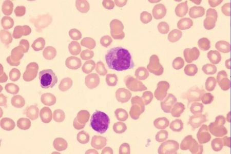 يطلق Babio حل Giemsa Stain عالي الجودة للمختبرات العالمية