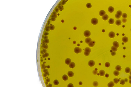 يقوم Babio بإطلاق قاعدة أجار عالي الجودة من Baird-Parker لاختبار المكورات العنقودية الموثوقة
