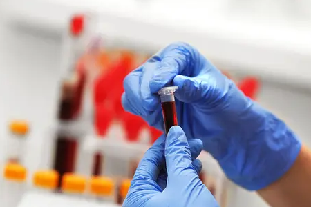 تطلق BABIO اختبارًا سريعًا للحمل البقري